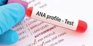 آزمایش ANA Profile( آنتی بادیهای هستهای) چیست؟