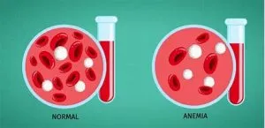 انواع کمخونی و ۶ تستهای افتراقی آنها