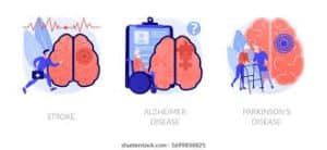 بیماری های عصبی