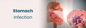 عفونت های معده