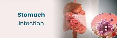 عفونت های معده