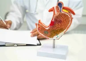 آندوسکوپی معده