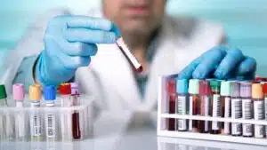 تشخیص بیماریهای سرطانی