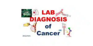 تشخیص بیماریهای سرطانی