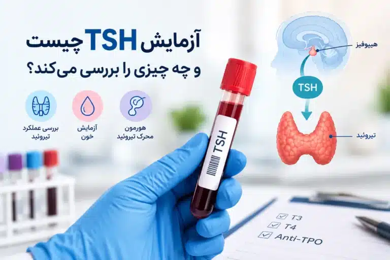 آزمایش TSH چیست و چه چیزی را بررسی میکند؟